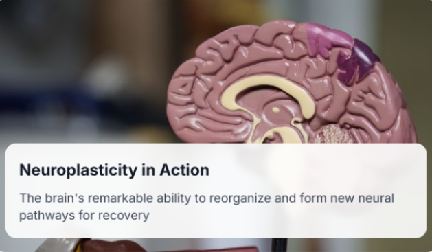 neuroplasticity in action